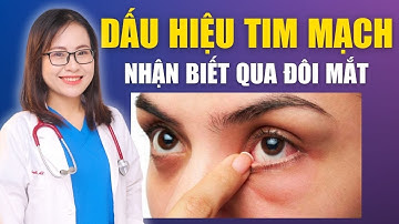 Nhận Biết Dấu Hiệu Bệnh Tim Mạch Qua Đôi Mắt |  Bác Sĩ Huyền
