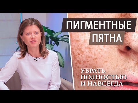 Пигментные пятна на лице - как избавиться (при беременности \\ после родов \\ после 40 лет)
