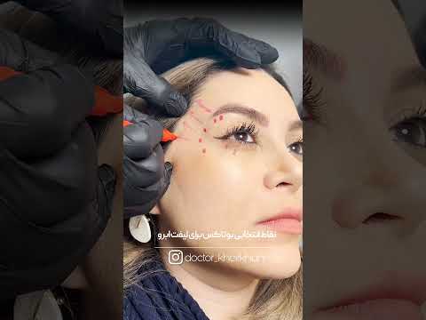 لیفت ابرو با بوتاکس
