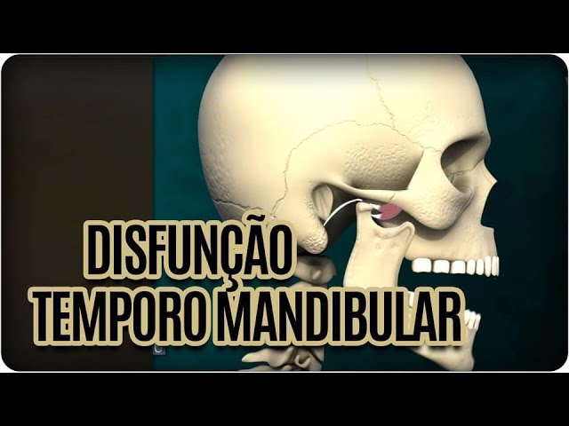 Disfunção da ATM - Clinica Originale