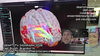 Live EEG Brain Scan at SIGGRAPH 2026 — Dell Booth Real-Time 3D Brainwave Visualization 🧠