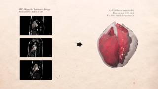 Alya Red -- A Large Scale Simulator Of The Human Heart