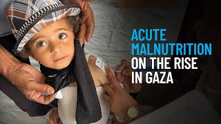 Malnutrisi Akut Meningkat di Gaza