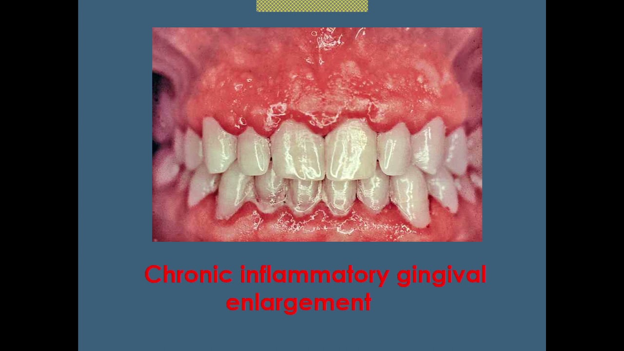Антифриз lec 2