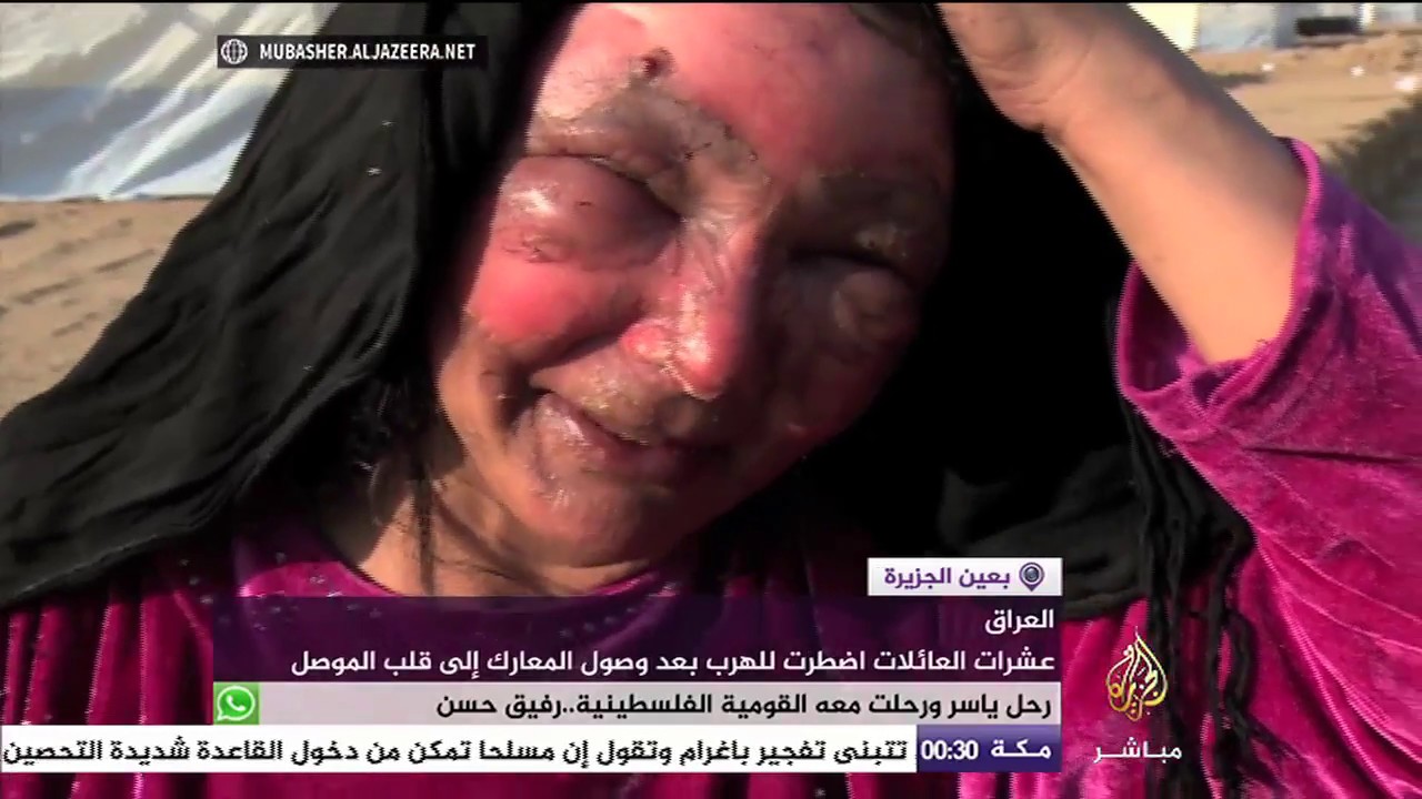 مأساة امرأة عراقية احترق قلبها قبل جسدها