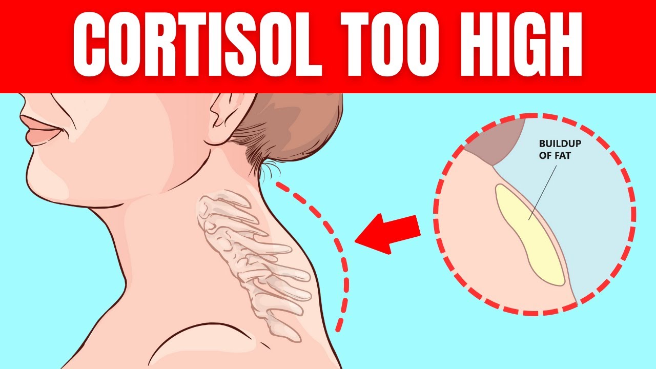 If You Spot This On Your Neck, Your Cortisol Is Dangerously High
