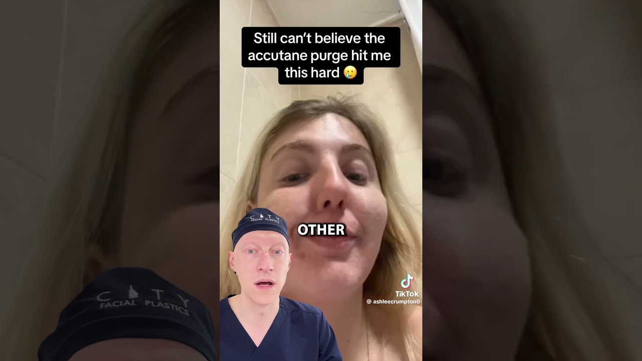 Accutane Purge Hits HARD | Doctor Reacts