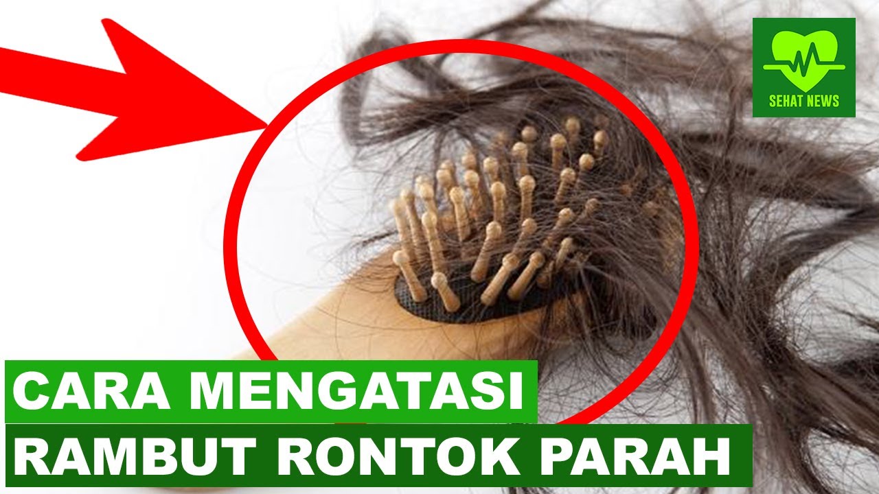 CARA MENGATASI RAMBUT  RONTOK  BERLEBIHAN  YouTube