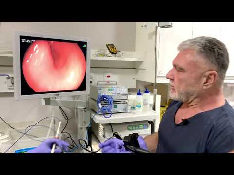 Endoscopia - Queixa de Dor Abdominal, Azia e Vômito