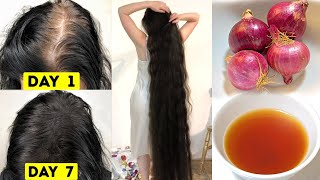 1 Weeks Challenage - Your Hair Will Grow Like Crazy | *EXTREME HAIR GROWTH*