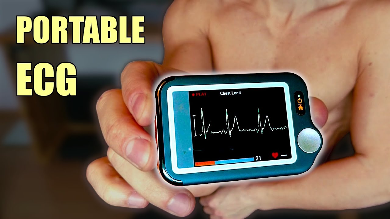 EKG Lab: Using the AliveCor KardiaMobile monitor to evaluate the