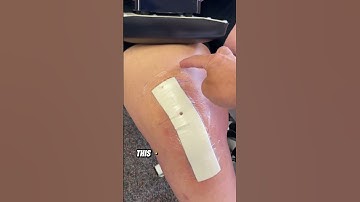 Day 2 of Physical Therapy After Total Knee Replacement - Dressing Assessment