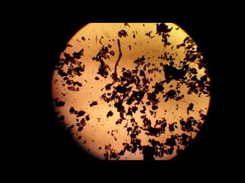 Vista con microscopio de microorganismos del musgo.