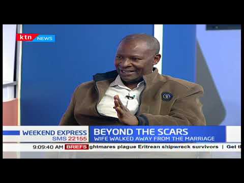 bulletin full video Beyond the Scars: 