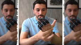 "He Lost His Fingers Training..."😱 screenshot 4