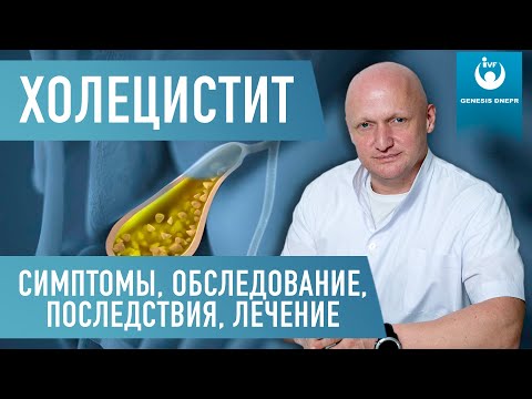 Холецистит. Воспаление желчного пузыря - что это такое, в чем опасность и как лечить. Хирург Щевцов