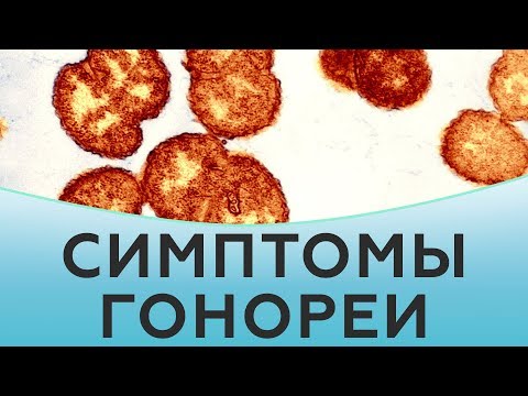 Как проявляется гонорея. Проявления гонореи. Симптомы гонореи