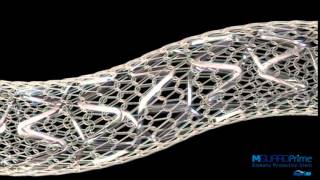 Dr. Gunn: STEMI Case with MGuard Prime™ screenshot 5