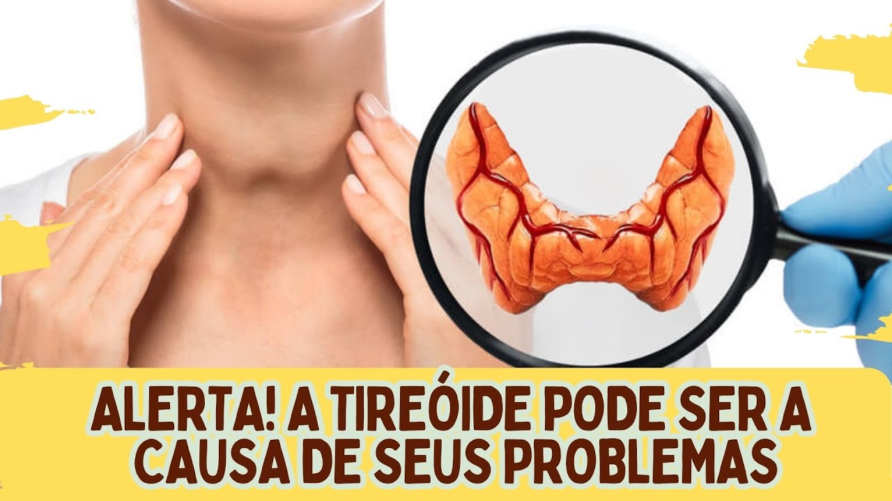 tire-ide-sintomas-de-altera-o-e-tratamento-dr-dayan-siebra-youtube