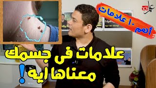 علامات فى جسمك معناها ايه ؟ - جسمك بيقولك ايه ؟ | علم تيوب