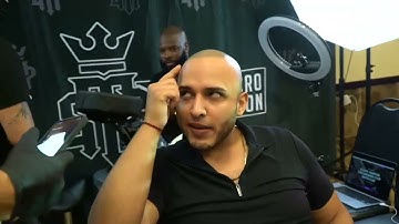 Scalp Micropigmentation Scottsdale, Az