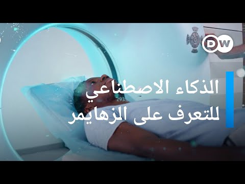 هل يمكن للذكاء الاصطناعي أن يعالج الزهايمر كليك