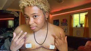 FTM | 7 Day Top Surgery Updates + Incision Reveal Net Worth