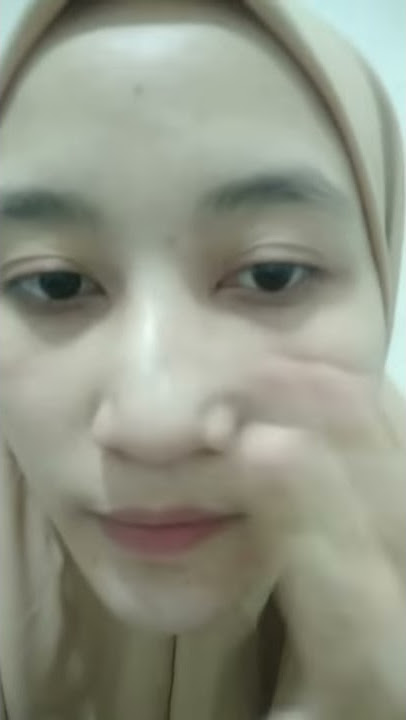 RIVIEW PEMAKAIAN CREAM KLT ORIGINAL // 3 HARI LANGSUNG BERUBAH !!!