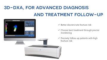 DMS Imaging | [FR] | 3D-DXA Teaser
