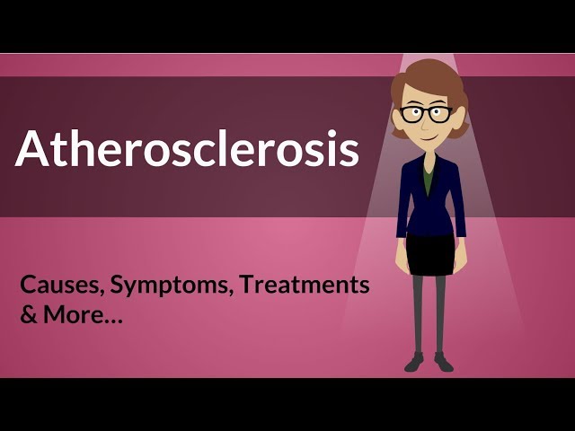 Atherosclerosis -  Causes, Symptoms, Treatments & More… class=