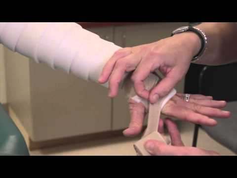 Wideo: Co to jest bandaż z wieloma ogonami?