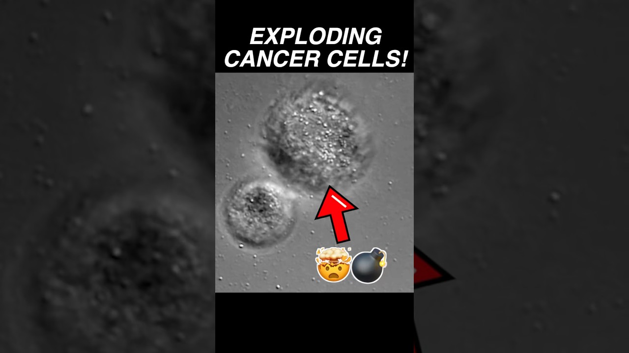 Melanoma (skin cancer) cells exploding in high pH medium 💣 