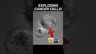 Melanoma Skin Cancer Cells Exploding In High Ph Medium