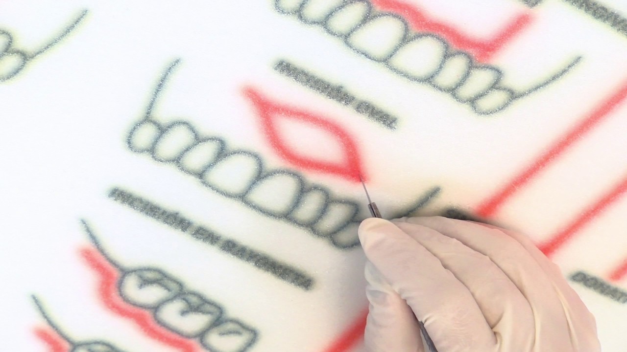 Oval Incision Incisión oval - YouTube