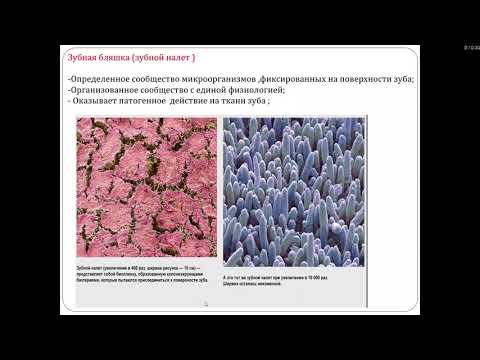 Кариесология 3. Кариес зубов. Теории происхождения, этиология, патогенез