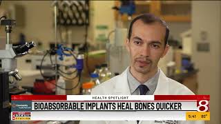 Health Spotlight: Bioabsorbable implants heal tiny bones quicker