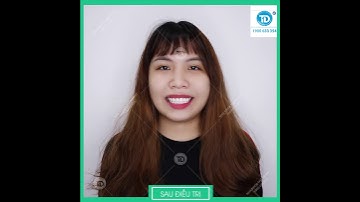 Phẫu Thuật Giảm Hô - Cười Hở Lợi Tại Nha Khoa Uy Tín Biên Hòa