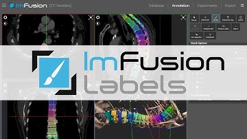 ImFusion Labels - Optimize your AI Workflow with Medical Images