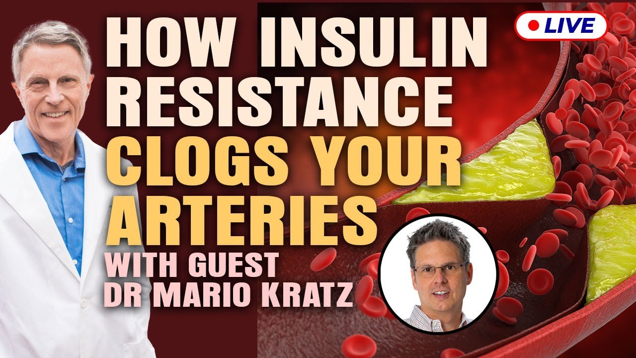 Dr Mario Kratz: This Is How Insulin Resistance Clogged Arteries