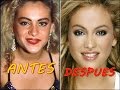 LAS MEJORES CIRUGIAS PLASTICAS DE FAMOSOS