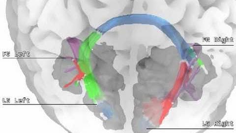 OpenWalnut: Visualization of Effective Connectivity of the Brain