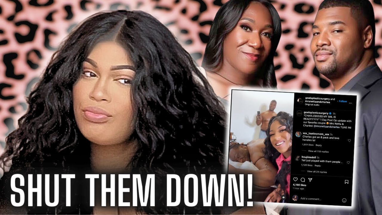 TIKTOK TEA Mrs Netta Charles Are BOTCHED Goals Plastic Surgery tiktok-tea-mrs-netta-charles-are-botched-goals-plastic-surgery