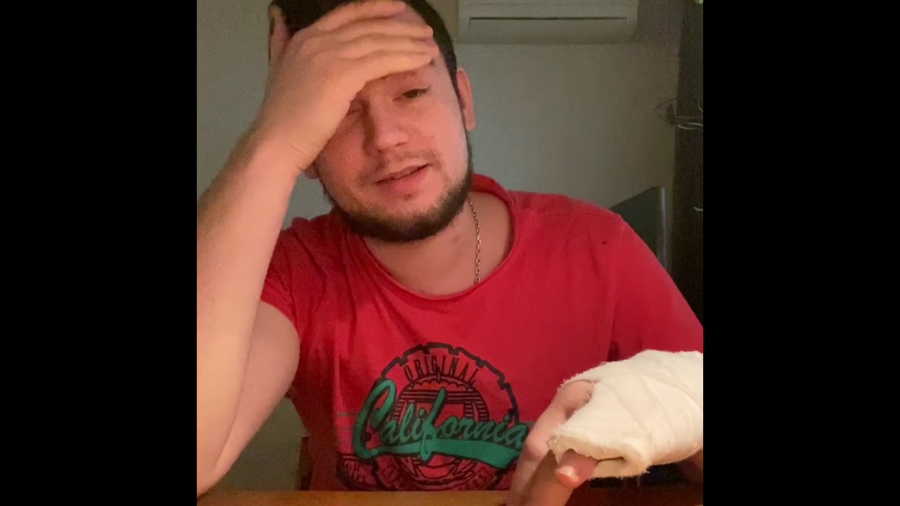 РАЗРЫВ Сухожилий и ПЕРЕЛОМ Кисти РУКИ - YouTube