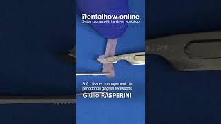 Dr. Giulio Rasperini | Soft Tissue Management | Online Masterclass 2023 #dentist #dentistry #perio screenshot 1