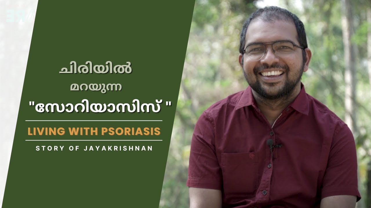 Living with Psoriasis | Jayakrishnan's story | Dr. Padmanabha Shenoy