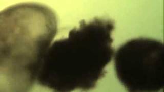 Ostracodes