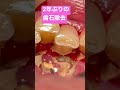 2年でこんなに歯石が溜まってしまいました😭 Lots of tartar buildup in two years.