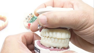 PRINTED TRY IN | Otella Dental