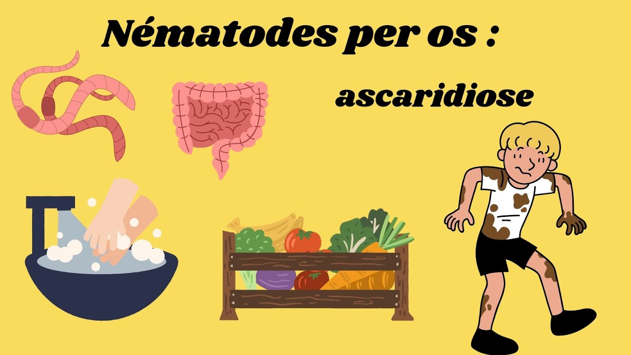 Nématodes par transmission per os : Ascaridiose by Nesrine