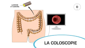 Comment sont les selles après une coloscopie ?